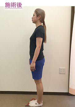 初回 施術後