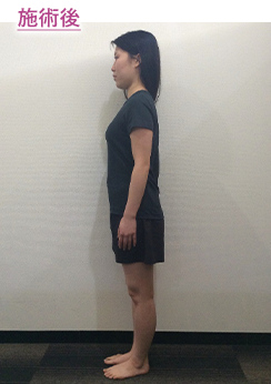 初回 施術後